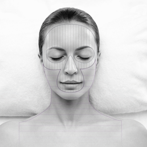 Fragile capillaries - Redness